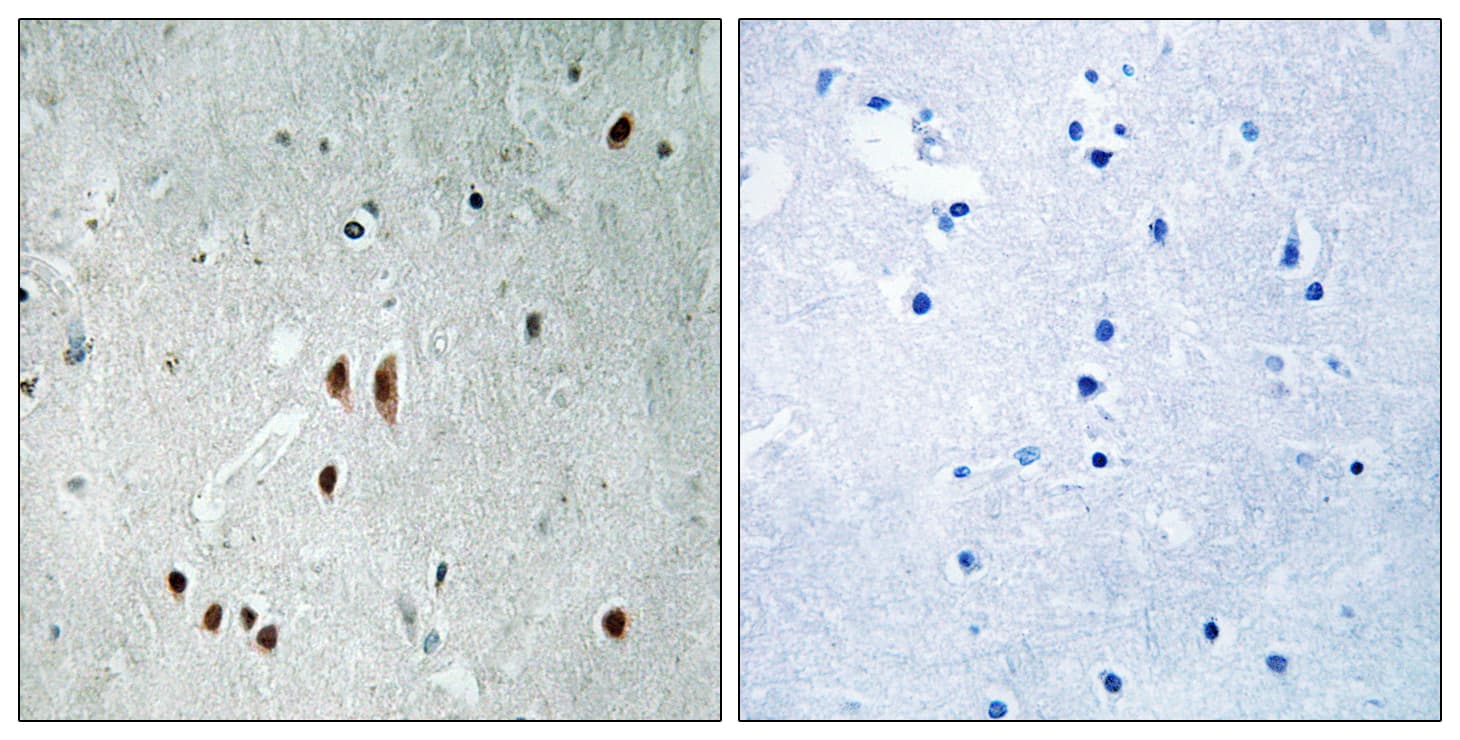 CNOT2 Antibody (phospho-Ser101)