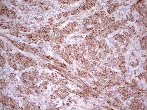 NFS1 Antibody (aa1-299, clone OTI2H5)