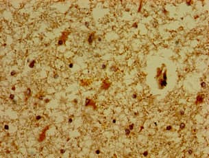 MC5R / MC5 Receptor Antibody