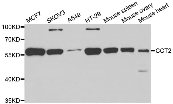 CCT2 / CCT Beta Antibody