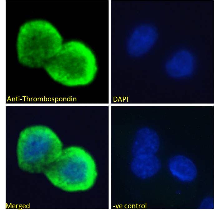 IHC-plus™ THBS1 / Thrombospondin-1 Antibody (aa19-32)