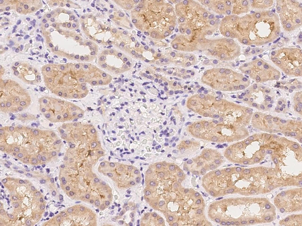 KCNA6 / Kv1.6 Antibody