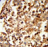 C1QTNF6 / CTRP6 Antibody (aa27-53)