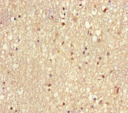 Polyclonal Rabbit anti-Human MMS2 / UBE2V2 Antibody (WB)