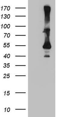CYTH2 / Cytohesin 2 Antibody (clone OTI4D9)