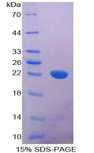 Human IL-1B / IL-1 Beta Protein (Recombinant His-T7)