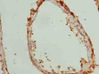 Polyclonal Rabbit anti-Human TTLL6 Antibody (IHC)