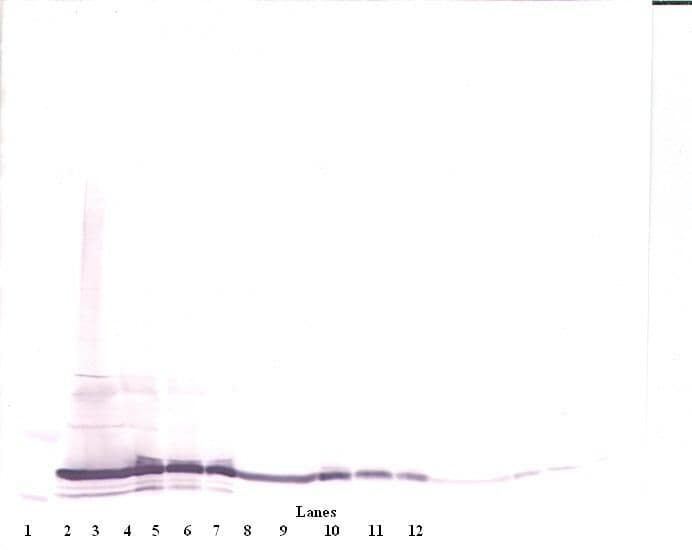 IL17F Antibody