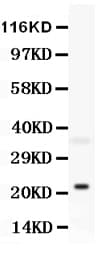 Polyclonal Rabbit anti-Mouse BID Antibody (aa179-195, IHC, WB)