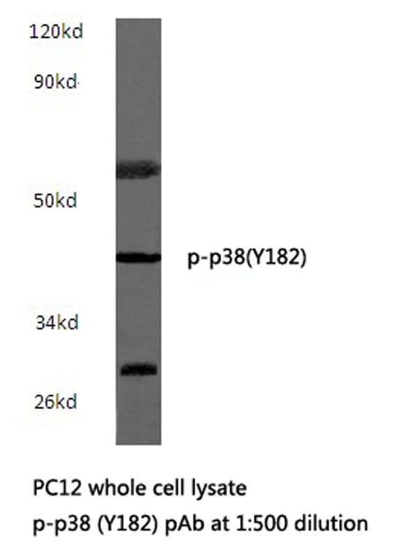 Polyclonal Rabbit anti-Human MAPK14 / p38 Antibody (phospho-Tyr182, IHC, WB)