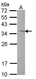 Polyclonal Rabbit anti-Human Rhodanese / TST Antibody (aa1-270, IHC, WB)