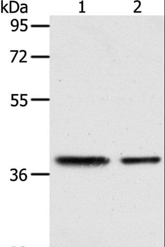 Polyclonal Rabbit anti-Human CNN3 Antibody (IHC, WB)