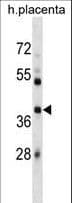 SIAH1 Antibody (aa92-120)