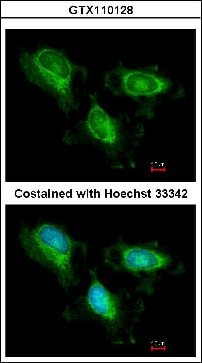 IHC-plus™ FH / Fumarase / MCL Antibody (aa89-365)