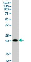 RHOC Antibody (clone 2E12)