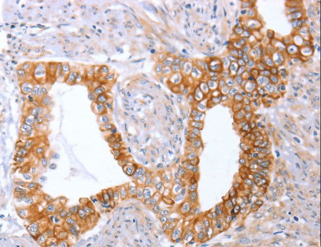 Polyclonal Rabbit anti-Human ABO Glycosyltransferase Antibody (IHC)