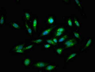 ATP2C1 Antibody
