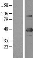 Human YY1 Protein (Over-Expression Lysate Myc-DDK (Flag))