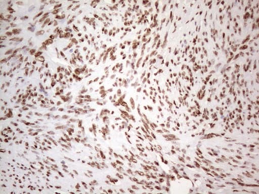 HNRNPL / hnRNP L Antibody (aa270-502, clone OTI4E5, Carrier-free)