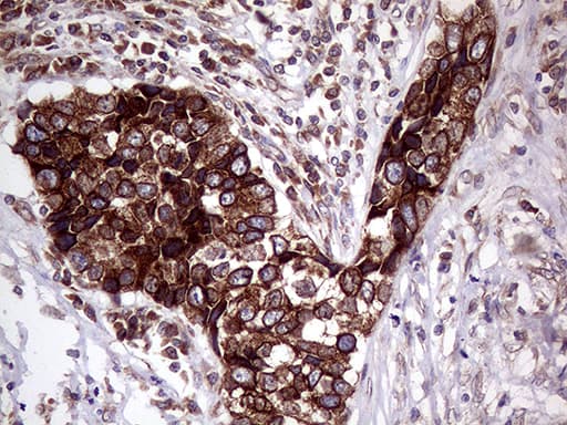 L3 / LASS2 Antibody (aa62-136, clone OTI3D9)