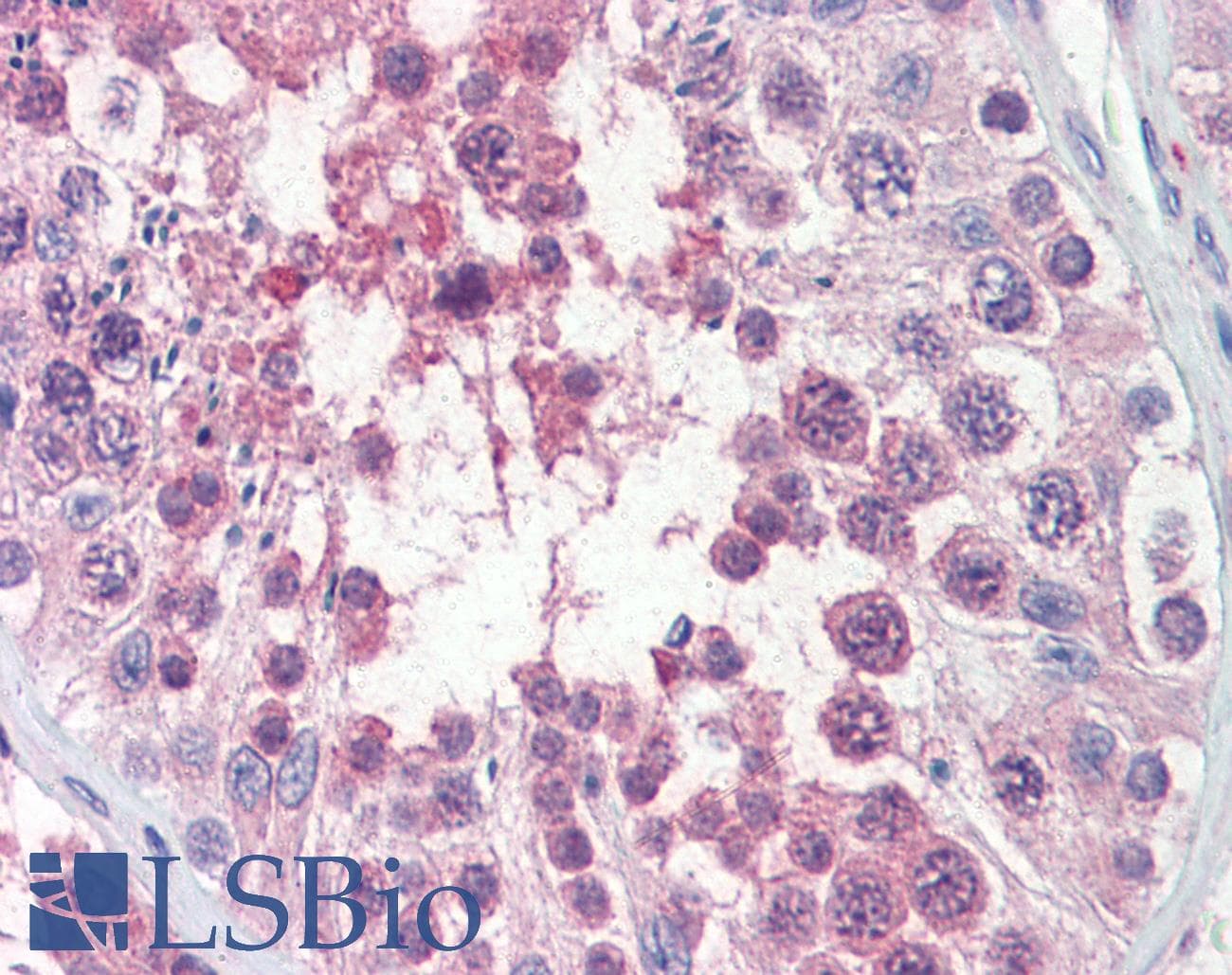Polyclonal Rabbit anti-Human TRIM8 / GERP Antibody (aa36-85, IHC, WB)