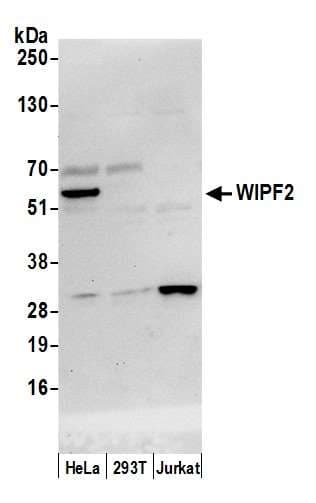 WIPF2 / WIRE Antibody (aa75-125)