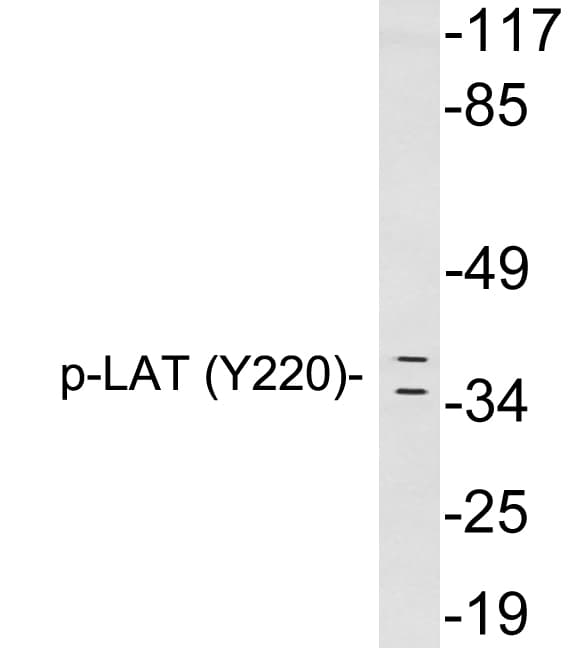 LAT Antibody (phospho-Tyr220)