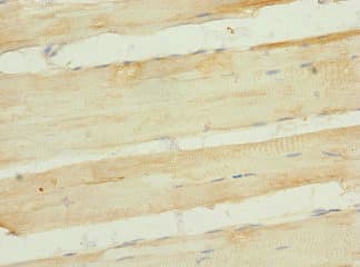 Polyclonal Rabbit anti-Human FHL3 Antibody (IHC)