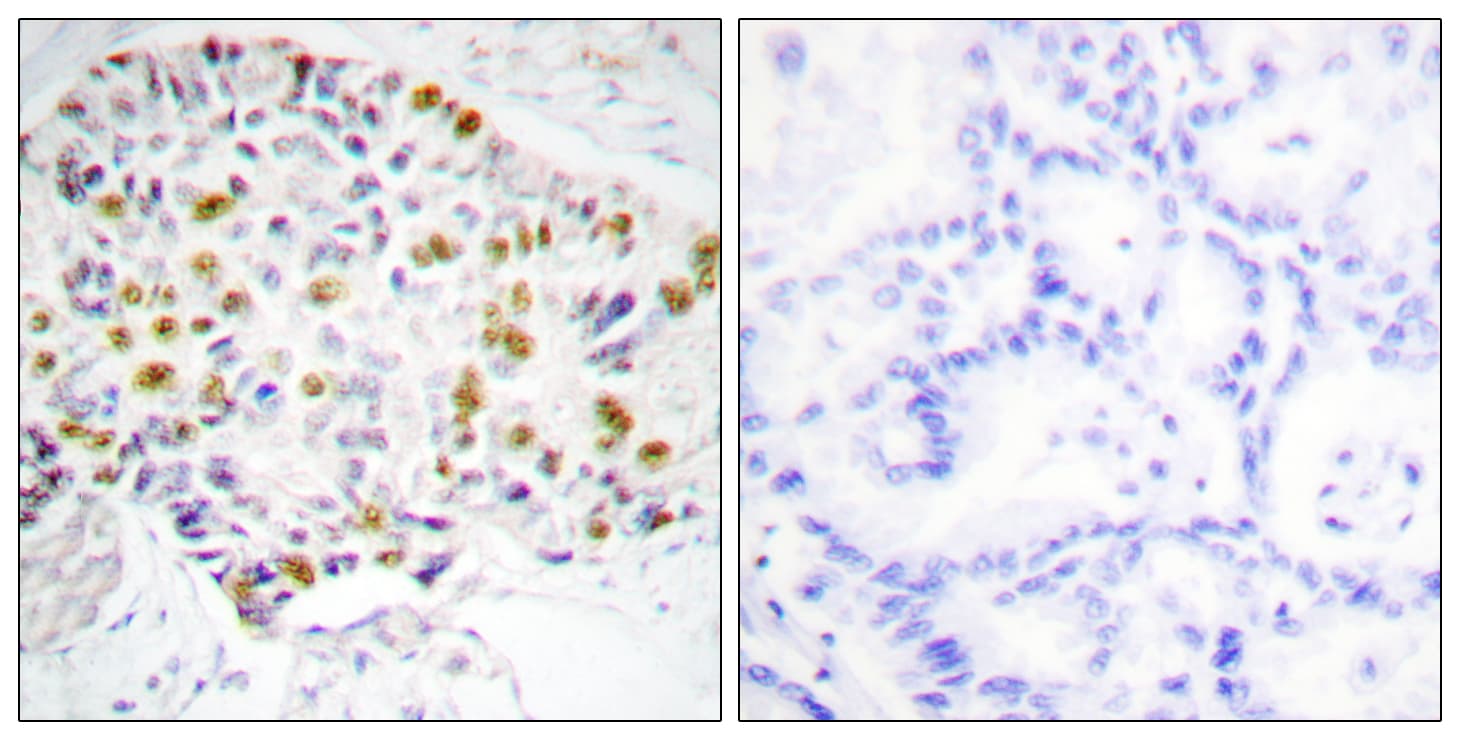 Polyclonal Rabbit anti-Human RB1 / Retinoblastoma / RB Antibody (aa211-260, IHC, IF)