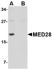IHC-plus™ Polyclonal Rabbit anti-Human MED28 / Magicin Antibody (IHC, WB)