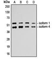 TP53 / p53 Antibody (C-Terminus)