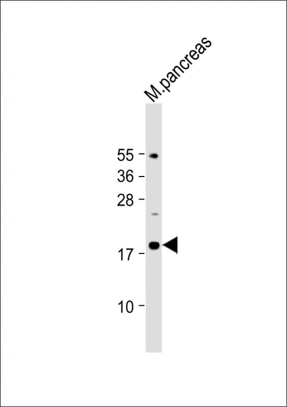 IL23A / IL-23 p19 Antibody (Internal)