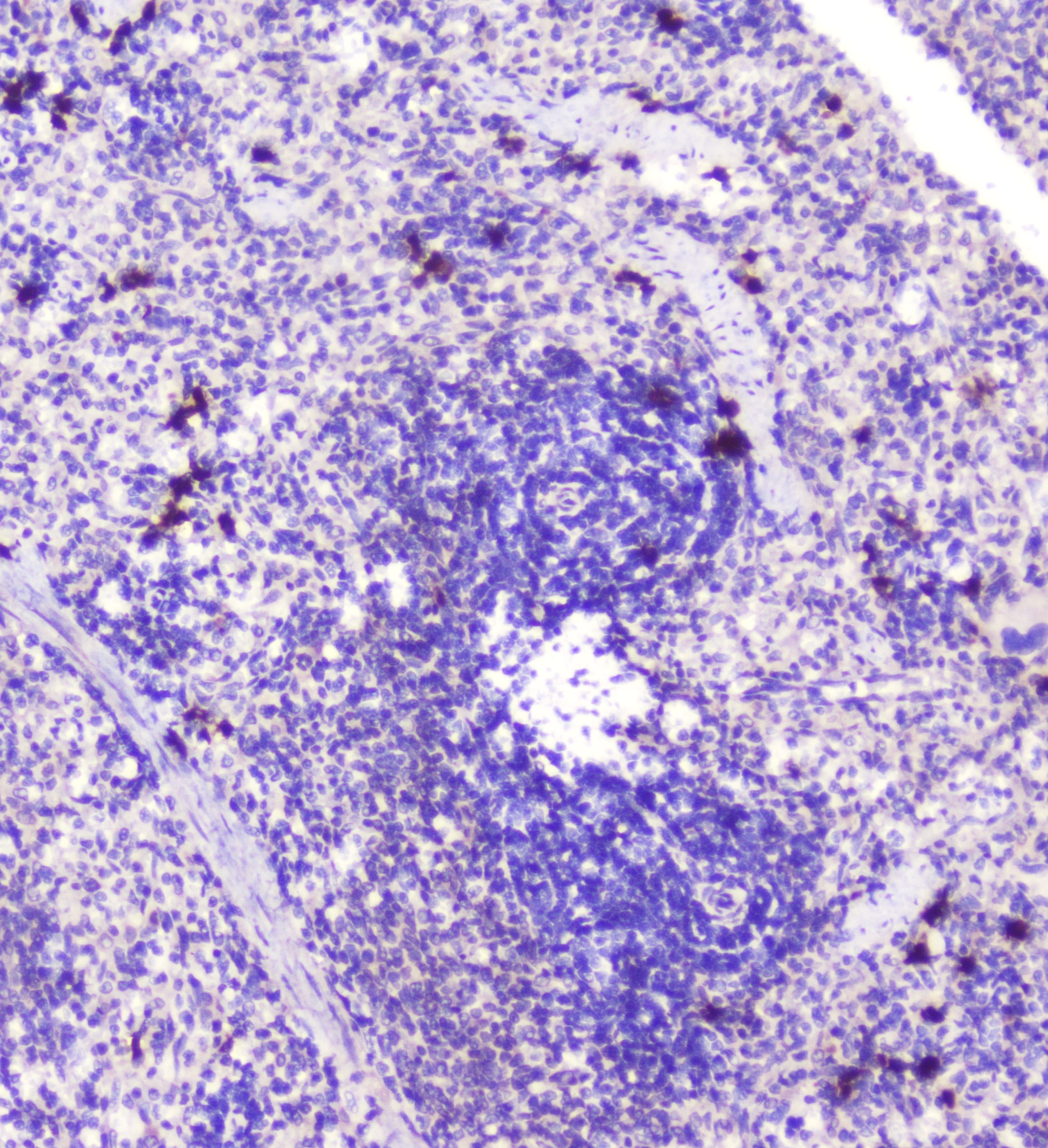 RASAL1 / RASAL Antibody