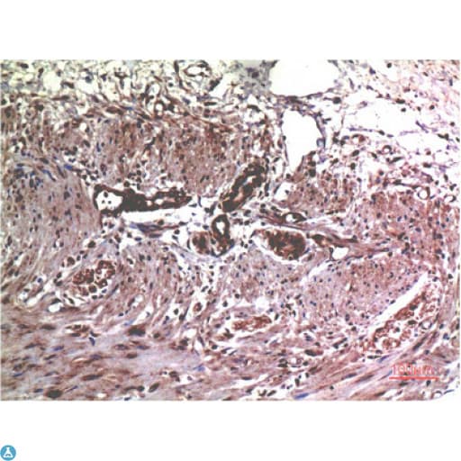 MMP2 Antibody