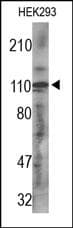 PDGFRA / PDGFR Alpha Antibody