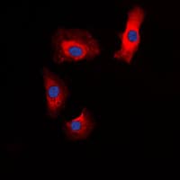 Polyclonal Rabbit anti-Human IAPP / Amylin Antibody (N-Terminus, IHC, IF, WB)