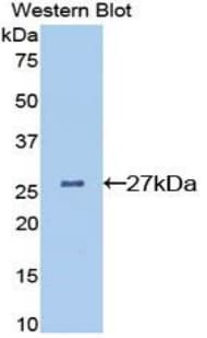 CLU / Clusterin Antibody (aa227-447)