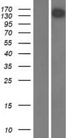 USP31 Protein (Over-Expression Lysate Myc-DDK (Flag))