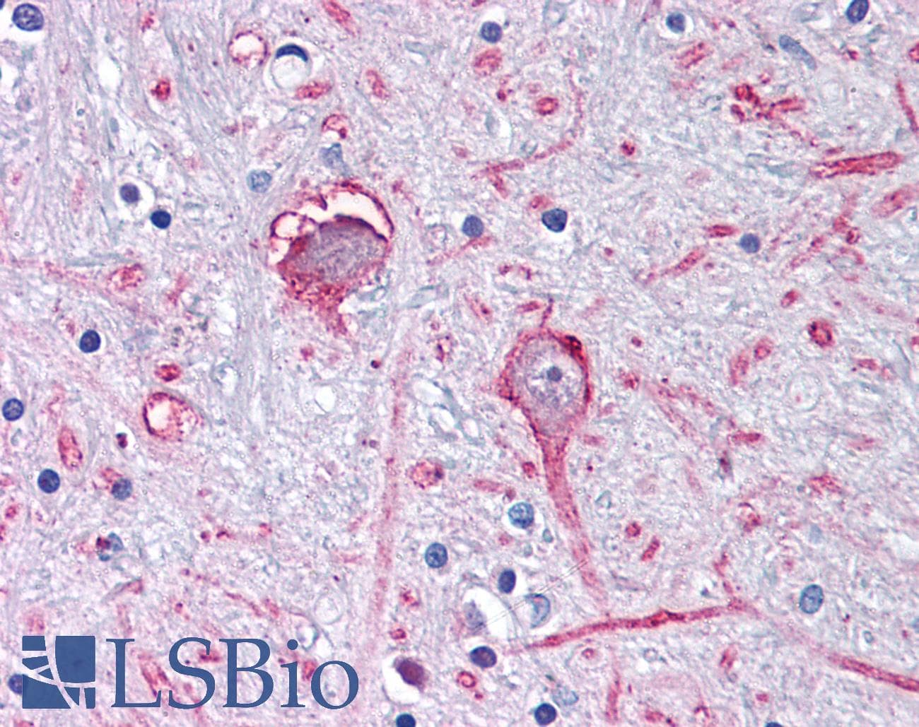PathPlus™ GABRA3 Antibody (C-Terminus)