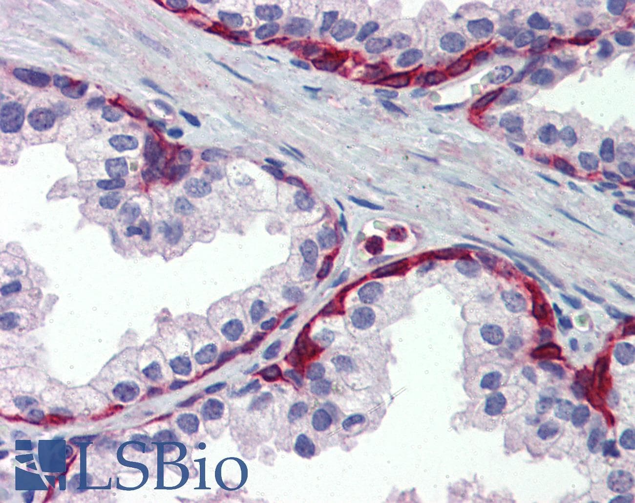 IHC-plus™ Polyclonal Rabbit anti-Human METTL7A Antibody (IHC, IF, WB)