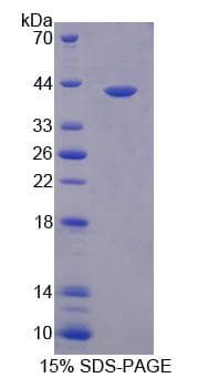 Human PARP4 / VPARP Protein (Recombinant His-T7)
