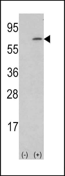 CSF1 / MCSF Antibody (aa230-257)
