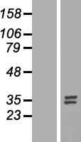 NUBPL Protein (Over-Expression Lysate Myc-DDK (Flag))