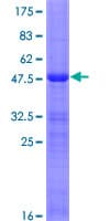 Human DLX6 Protein (Recombinant GST)