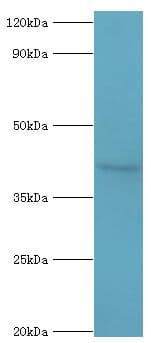 TRAIL-R4 / DCR2 Antibody (aa257-386)