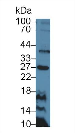 CD30L / CD153 Antibody (aa68-231)