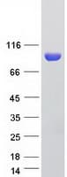 Human R1 / RRM1 Protein (Recombinant Myc-DDK (Flag))