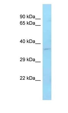 ZFP36L1 Antibody (C-Terminus)