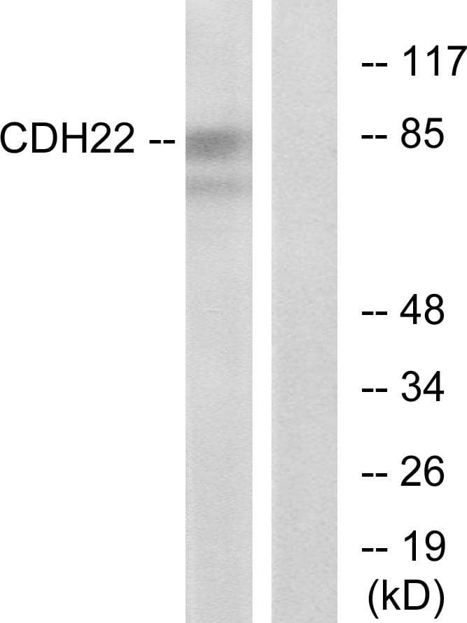 Polyclonal Rabbit anti-Human CDH22 / Cadherin 22 Antibody (IHC, IF, WB)