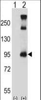 TRPC3 Antibody (aa765-793)